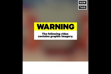 thiết bị có thể in một lớp da mới để chữa lành vết thương hở.