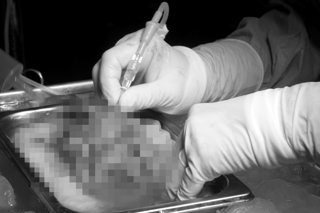 Mất con vì căn bệnh quái ác, cô gái hồi sinh cuộc đời nhờ được bố hiến thận - 1 Mất con vì căn bệnh quái ác, cô gái hồi sinh cuộc đời nhờ được bố hiến thận - 1