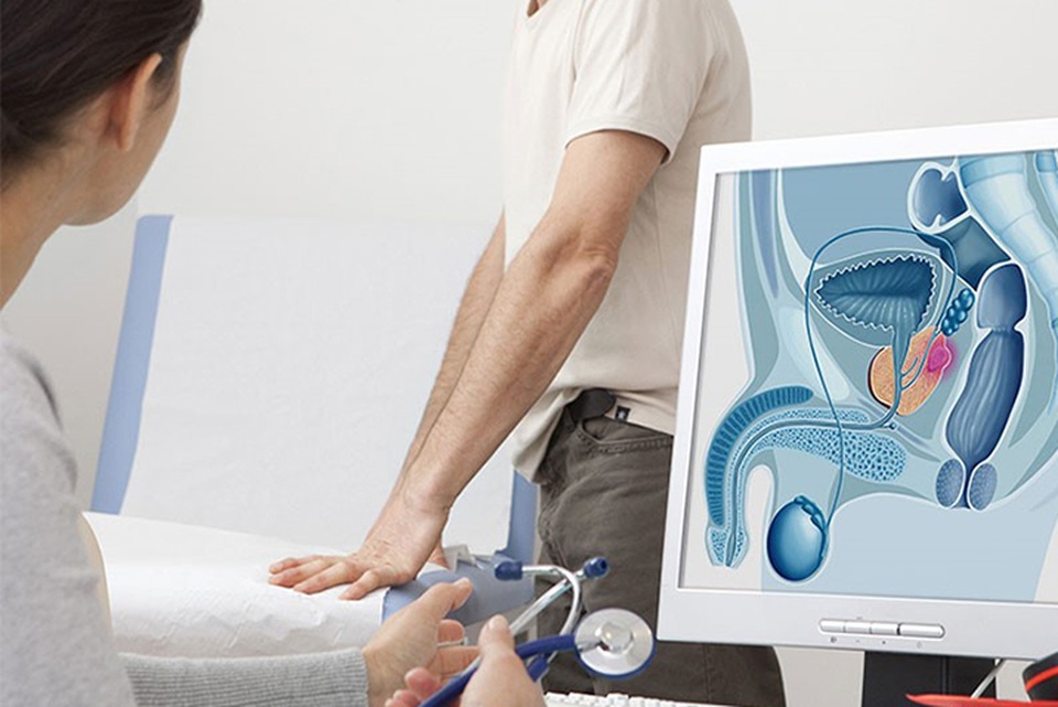 Có 7 biểu hiện này ung thư tuyến tiền liệt đã di căn - 1 Có 7 biểu hiện này ung thư tuyến tiền liệt đã di căn - 1