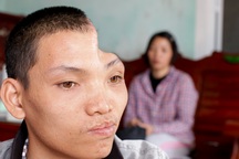 Thương người phụ nữ bán rau, chồng mất tích, con trai sống với nửa hộp sọ