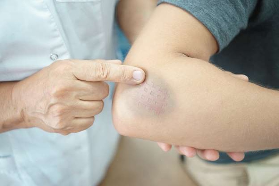 17 triệu chứng nhỏ có thể là dấu hiệu của vấn đề sức khỏe nghiêm trọng - 3 17 triệu chứng nhỏ có thể là dấu hiệu của vấn đề sức khỏe nghiêm trọng - 3
