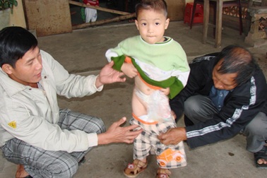 Bé trai 5 tuổi sống nhờ ống nhựa dẫn từ não