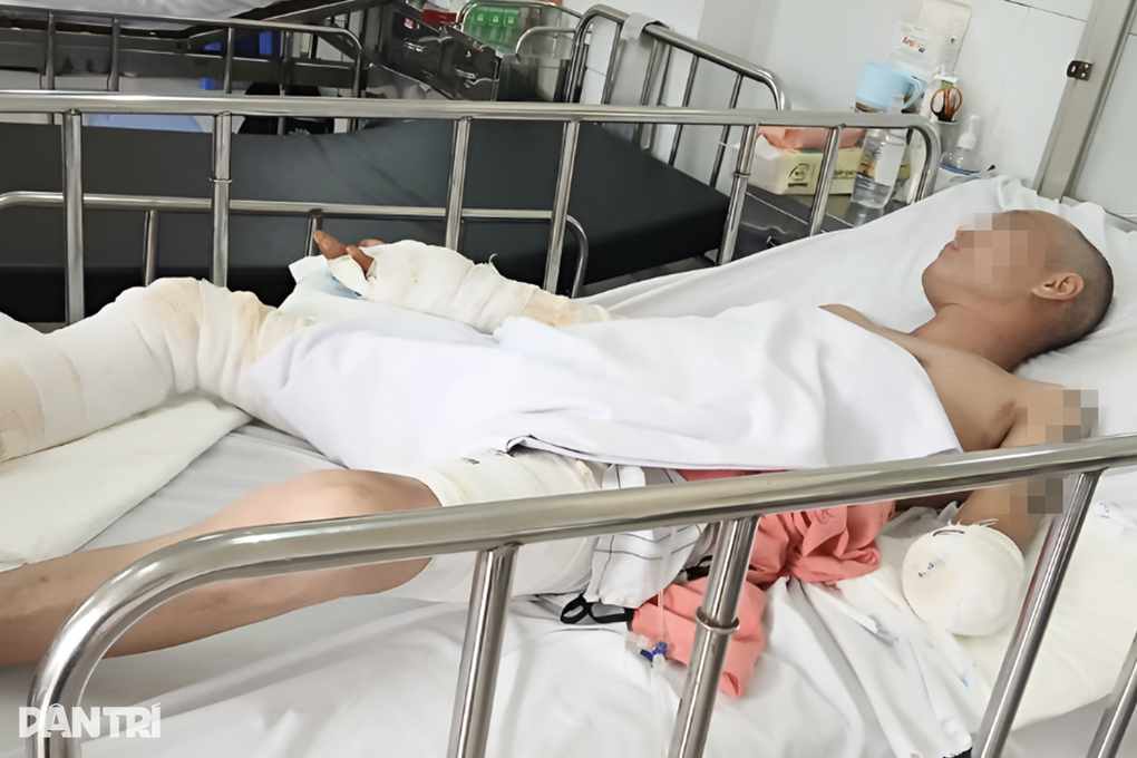 TPHCM: Cấp cứu nhiều ca ngưng tim, cắt cụt tay vì bị điện giật trên mái nhà - 1