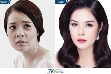 Dương Cẩm Lynh lần đầu chia sẻ bí quyết trẻ mãi không già