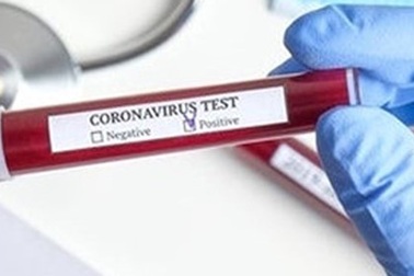 Đánh giá đúng kết quả xét nghiệm Covid-19