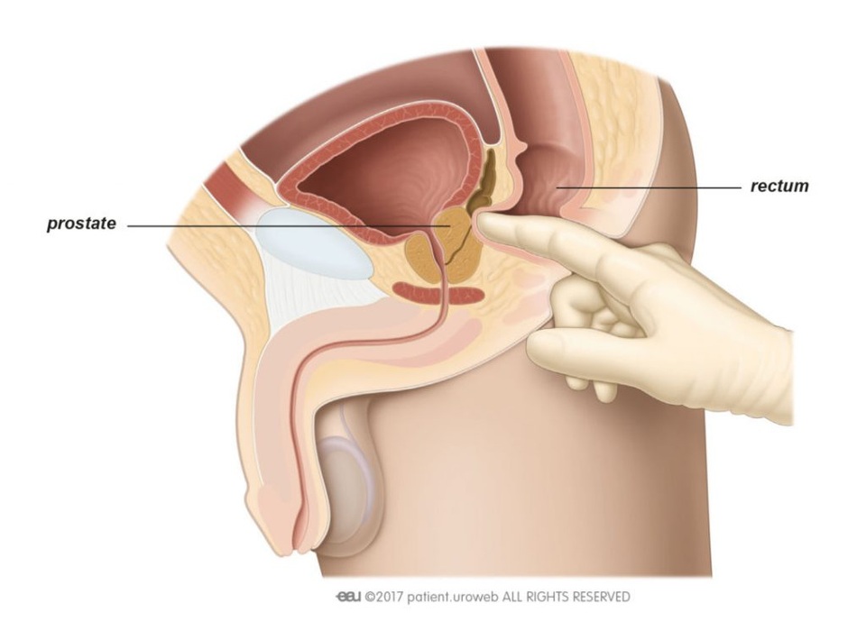 Những phương pháp tầm soát ung thư giúp bạn chủ động trước bệnh tật - 11 Những phương pháp tầm soát ung thư giúp bạn chủ động trước bệnh tật - 11