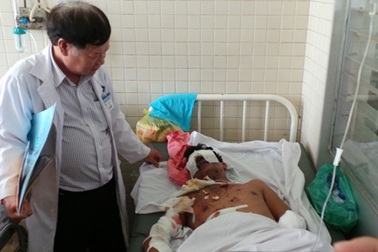 Hai anh em vỡ mắt, cụt tay khi đánh cá bằng thuốc nổ