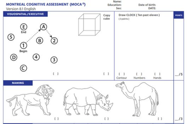Hé lộ bài kiểm tra nhận thức Tổng thống Trump ghi điểm tuyệt đối