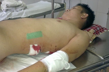 Vụ kỹ sư bị đâm chém dã man: Hung thủ có thể bỏ trốn