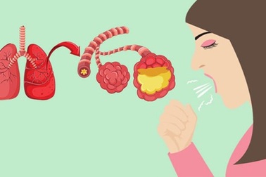 Bộ Y tế giám sát ngăn ngừa căn bệnh viêm phổi cấp nguy hiểm từ Trung Quốc lan sang Việt Nam