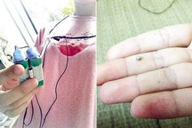 Thí sinh bị đình chỉ thi vì cài thiết bị công nghệ cao quanh người