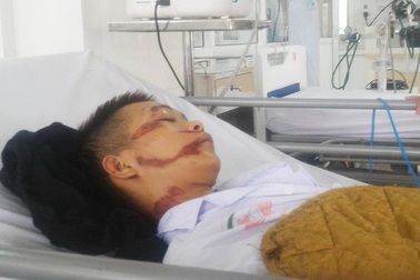 Dùng hung khí  truy sát 2 thanh niên rồi bỏ trốn