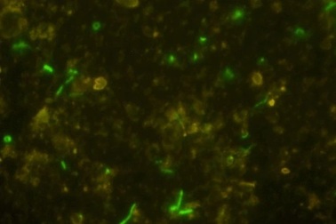 Phát hiện vi khuẩn cổ đại bị "nhốt" trong 2 tỷ năm