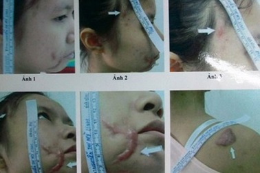 Kháng nghị tăng án kẻ chích điện vợ đang mang thai