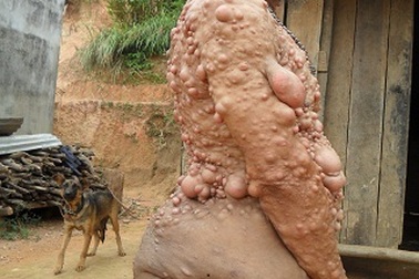 Xót thương 3 cha con mang hình hài... của quỷ