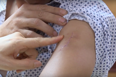 Trưởng công an xã bị đâm 6 nhát khi làm nhiệm vụ