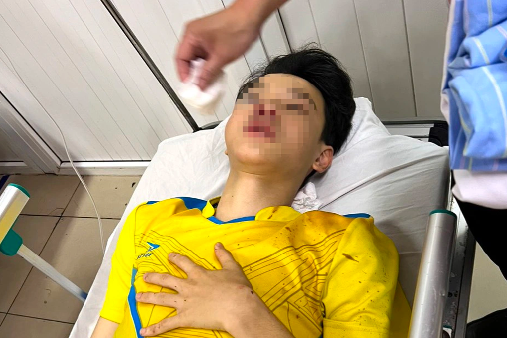 Gặp tai nạn trên đường đến trường, nam sinh phải bỏ thi giữa chừng - 1