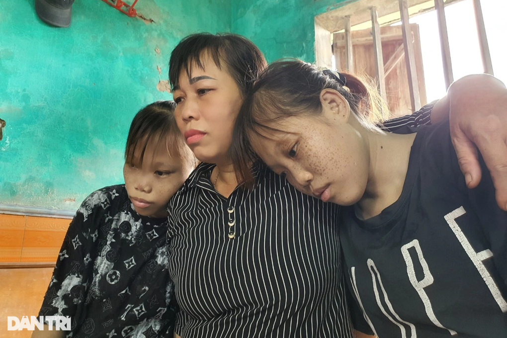 Cặp song sinh 20 năm sống bằng máu người khác ước năm nay có Tết - 6 Cặp song sinh 20 năm sống bằng máu người khác ước năm nay có Tết - 6
