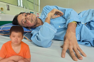 Bác sĩ kêu gọi cứu người cha nghèo nguy kịch vì thiếu tiền chữa trị