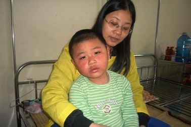 Hàng trăm trẻ em mắc bệnh sốt phát ban