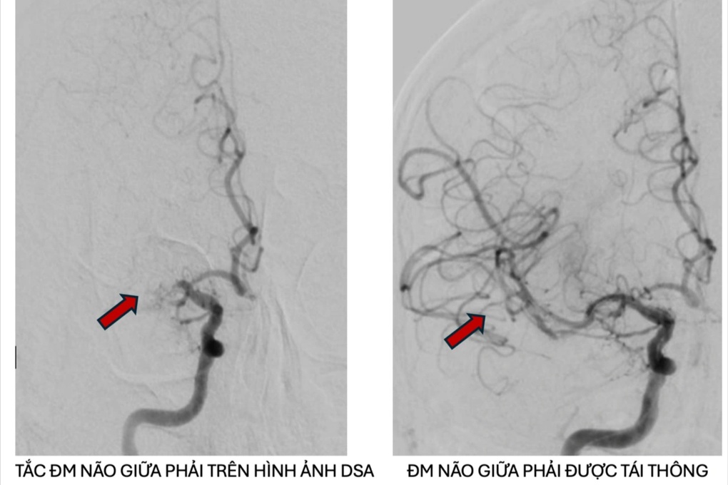 Nhiều người nước ngoài nguy kịch được bệnh viện ở TPHCM hồi sinh - 2 Nhiều người nước ngoài nguy kịch được bệnh viện ở TPHCM hồi sinh - 2