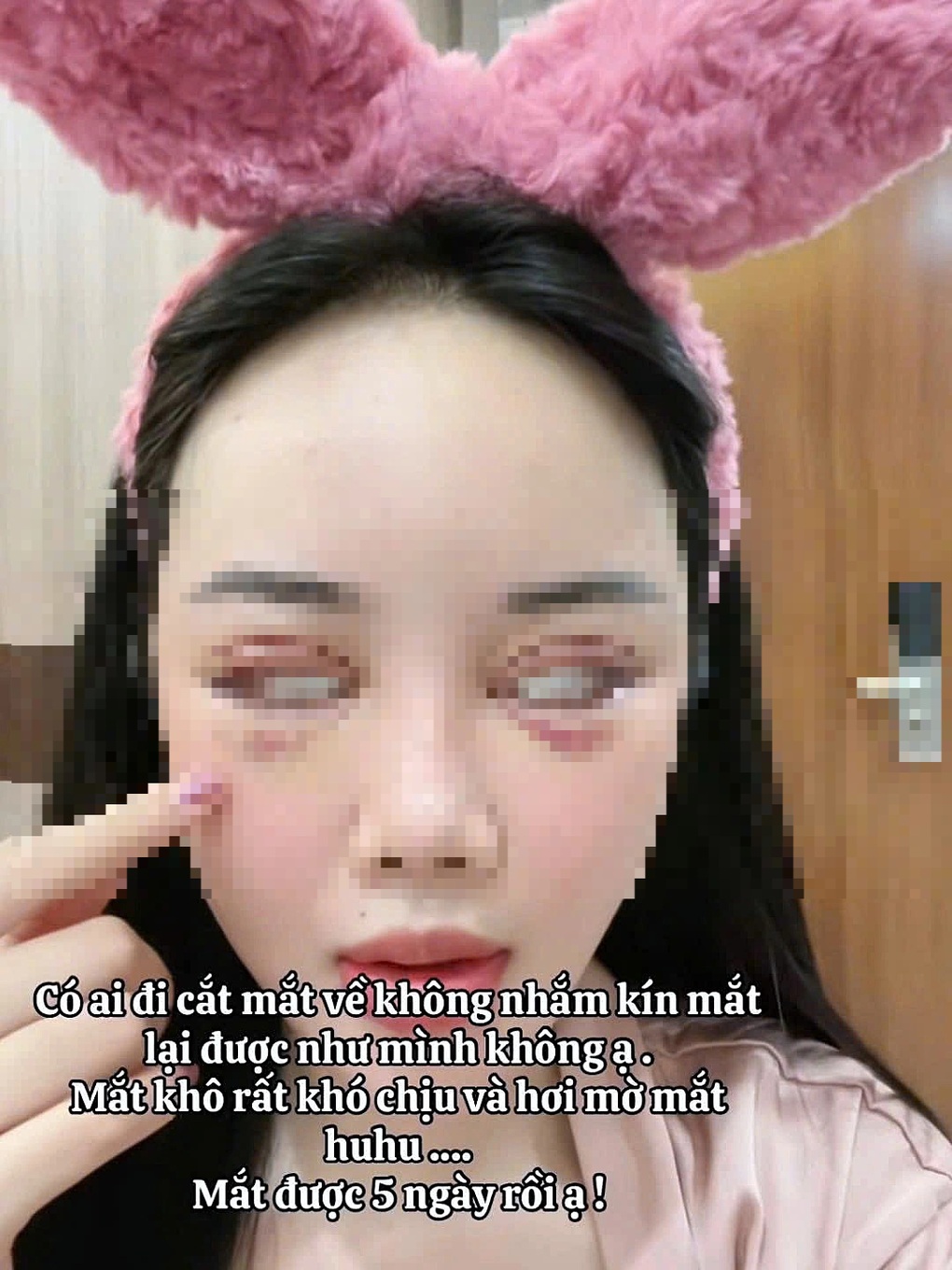 Cắt mí 5 ngày không nhắm được mắt, bác sĩ cảnh báo nguy cơ - 1 Cắt mí 5 ngày không nhắm được mắt, bác sĩ cảnh báo nguy cơ - 1