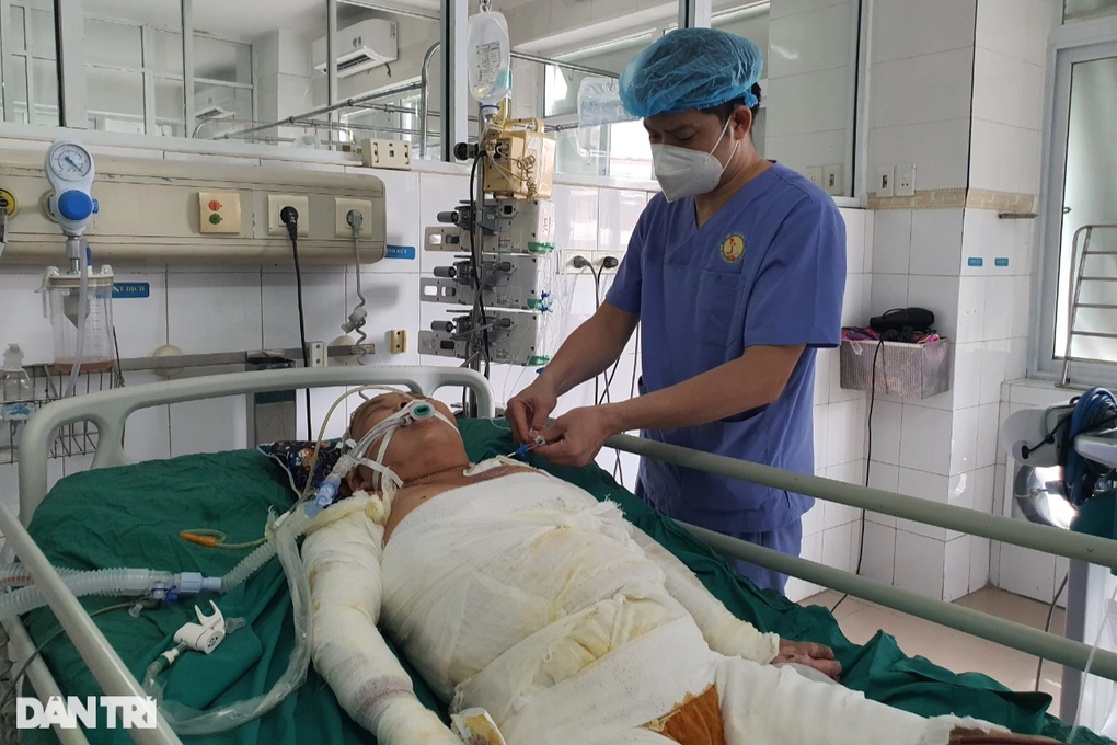 Vợ ngã vào chảo dầu sôi khi rán bánh, chồng hận mình sức yếu - 1 Vợ ngã vào chảo dầu sôi khi rán bánh, chồng hận mình sức yếu - 1