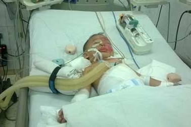 Hai trẻ đuối nước bị bỏ vào lu rồi hơ trên lửa 