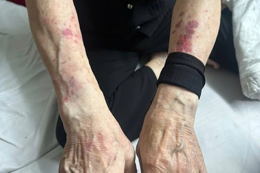 Đeo 16 cây vàng trên người, chủ nhà nghỉ ở Hà Nội bị cướp sạch