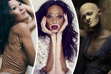 Những người mẫu thách thức mọi chuẩn mực thời trang