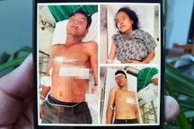 Mâu thuẫn với cha bạn gái, thanh niên đâm 3 người trọng thương