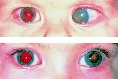 Gia đình có 3 người con trai đều mắc cùng một loại ung thư