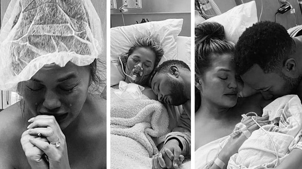 Siêu mẫu áo tắm Chrissy Teigen tiết lộ không thể mang thai lần nữa - 3 Siêu mẫu áo tắm Chrissy Teigen tiết lộ không thể mang thai lần nữa - 3