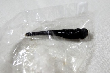 Gắp con vắt “khủng” ra khỏi khí quản trẻ 6 tuổi