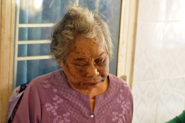 Nghịch tử đánh mẹ già đến nhập viện