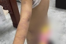 Làm rõ nghi vấn nhóm học sinh lớp 6 ở Hưng Yên bị bạo hành