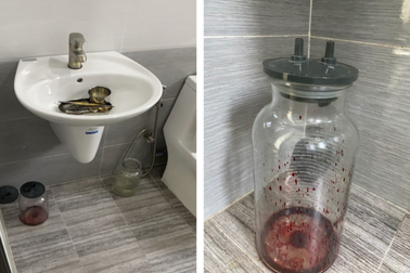 Phát hiện "bình máu tươi" trong cơ sở chăm sóc da