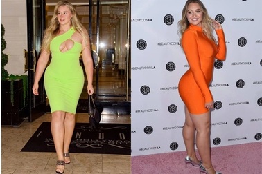 Câu chuyện về siêu mẫu xinh đẹp nặng gần... 90 kg