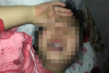 Hà Nội: Cháu bé nghi bị xâm hại nhiều lần đang rất hoảng loạn