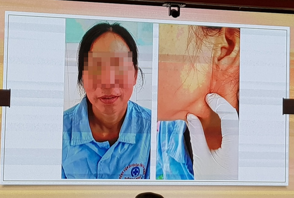 Bác sĩ ngồi Hà Nội hội chẩn ca ung thư ở Thái Bình - 1 Bác sĩ ngồi Hà Nội hội chẩn ca ung thư ở Thái Bình - 1