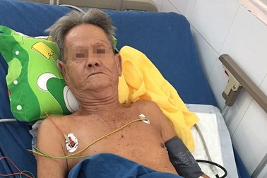 Cụ ông chết lâm sàng vì giấu bác sĩ tình trạng bệnh