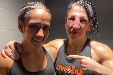 Nữ võ sĩ biến dạng khuôn mặt sau khi nhận... 236 cú đấm của đối thủ