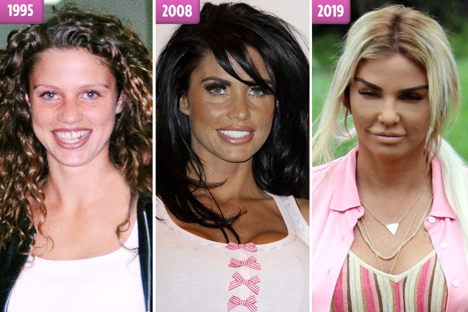 Người mẫu Katie Price thừa nhận 12 lần tu sửa vòng một - 7 Người mẫu Katie Price thừa nhận 12 lần tu sửa vòng một - 7
