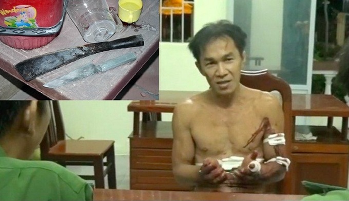 Nghi can không bình thường về thần kinh
