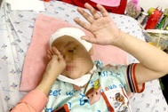 Bé gái 9 tuổi ở TPHCM bị tay thắng xe đạp điện đâm xuyên mắt giờ ra sao?