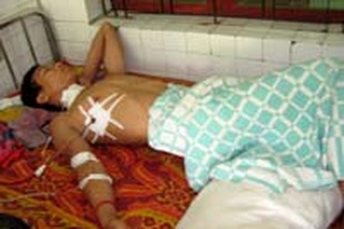 Bị đâm thủng phổi vì mâu thuẫn nhỏ