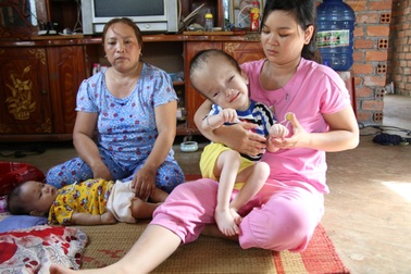 Hơn 187 triệu đồng đến với bé trai bị não úng thủy chưa một lần được đi viện