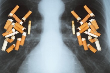 Cách nào thải độc nicotin do hút thuốc lá?