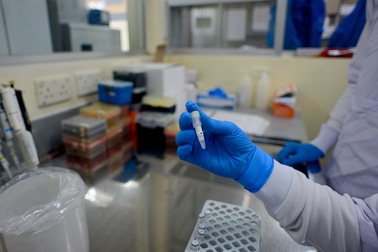 Nhiều ngày hết sốt, phi công nhiễm Covid-19 đến gần cơ hội ghép phổi