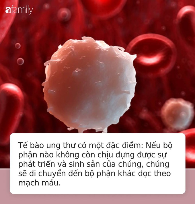 Chỉ nhìn bằng mắt thường cũng thấy 3 triệu chứng lạ này thì đừng chủ quan vì rất có thể bạn đã mắc ung thư giai đoạn cuối - Ảnh 2. Chỉ nhìn bằng mắt thường cũng thấy 3 triệu chứng lạ này thì đừng chủ quan vì rất có thể bạn đã mắc ung thư giai đoạn cuối - Ảnh 2.